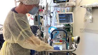 ECMO emergencies pump exchange [upl. by Ahsilav]