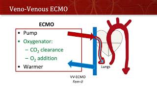 ECMO for EMS [upl. by Adnilav]