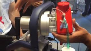 ECMO Treatment  Extracorporeal Membrane Oxygenation in Heart Failure  Max Hospital [upl. by Heidie]