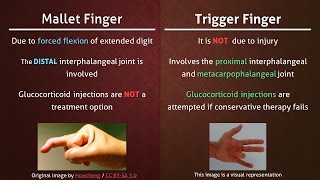 Mallet Finger vs Trigger Finger [upl. by Tham407]