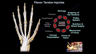 Flexor Tendon Injuries  Everything You Need To Know  Dr Nabil Ebraheim [upl. by Ilatan]