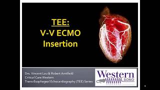 What is ECMO The basics explained [upl. by Tichonn]